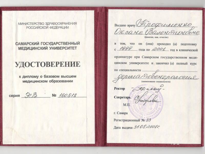 Удаление бородавок и папиллом жидким азотом